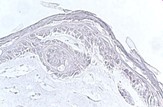 Cross section of the skin model  after 4 weeks of culture (invasive phenotype is presents).jpg