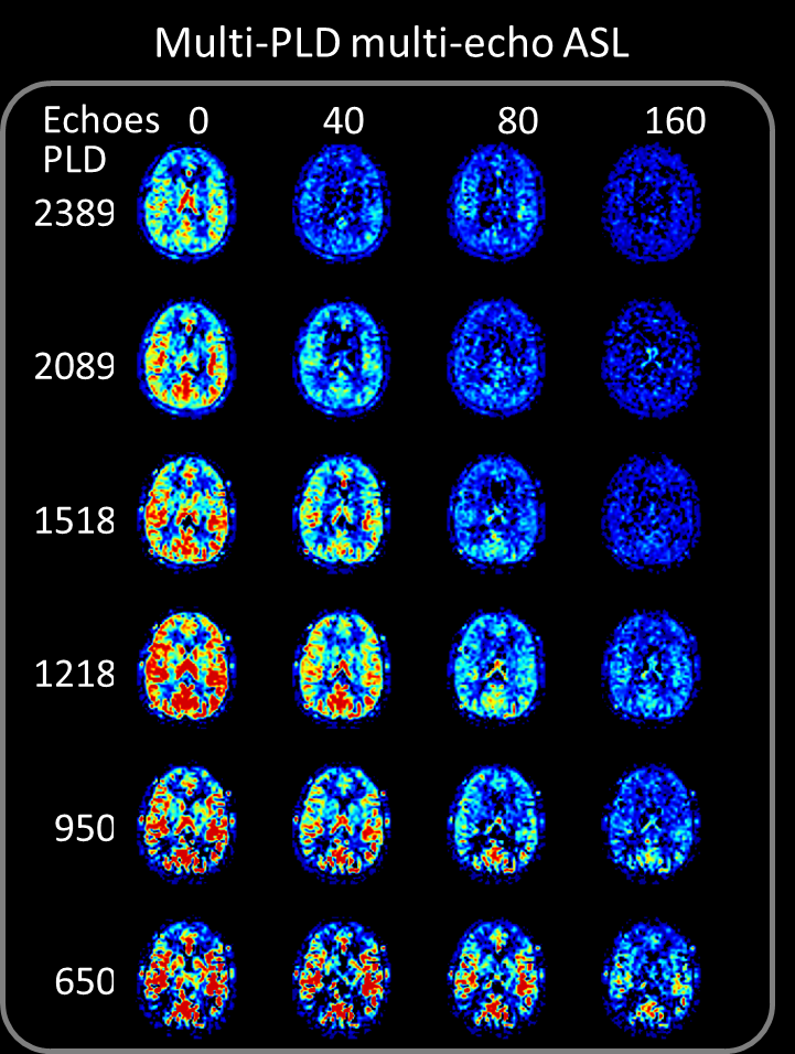 Multi echo ASL.png