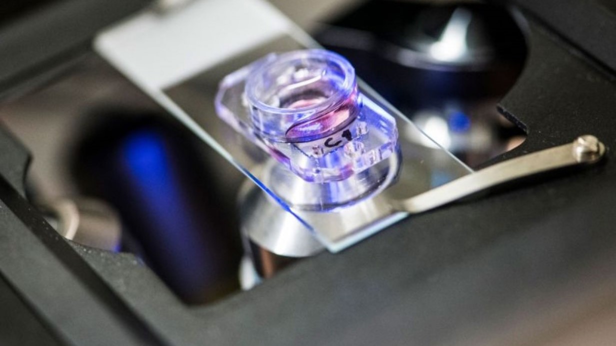 Orgaan-op-chip technologie