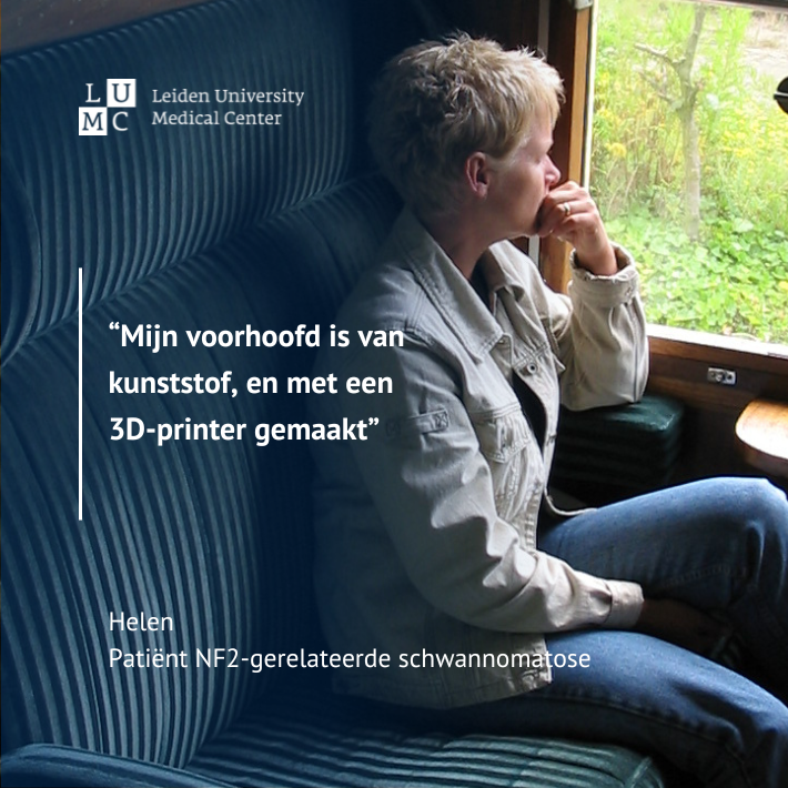 “Hij keek naar de scan van mijn hoofd en zei alleen maar: ‘Oh, oh, oh.’”
