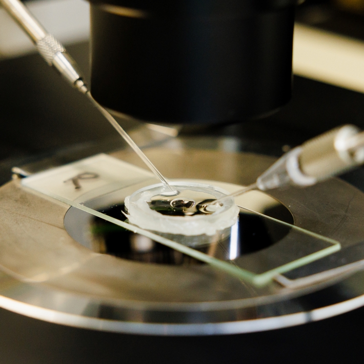 Microinjection