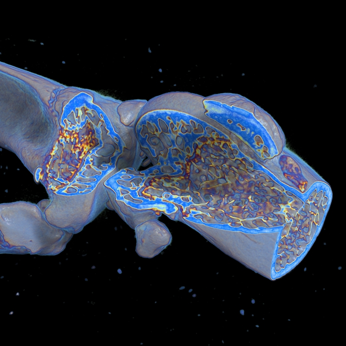Mouse picture of the knee taken with uCT