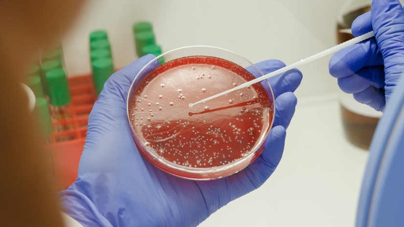 Aerobic and anaerobic culturing of microorganisms