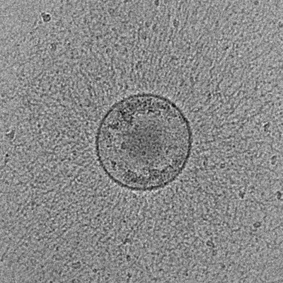 Cryo-EM image of an Extracellular Vesicle