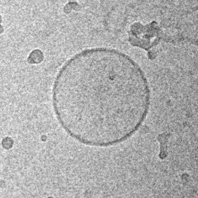 Cryo-EM image of a liposome