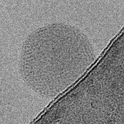 Cryo-EM image of a Lipid Nano Particle