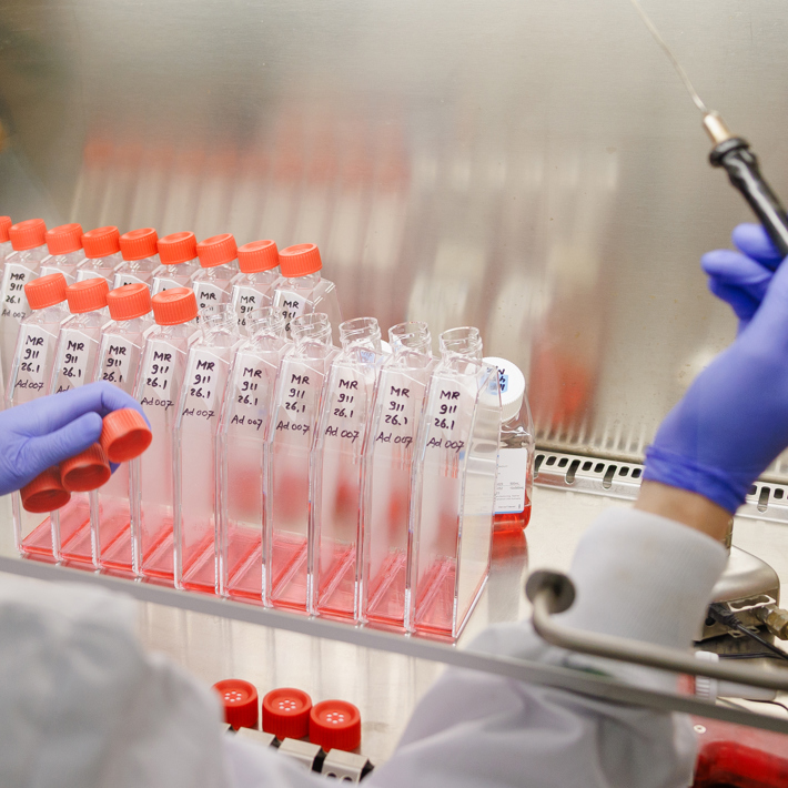 Adenovirus production