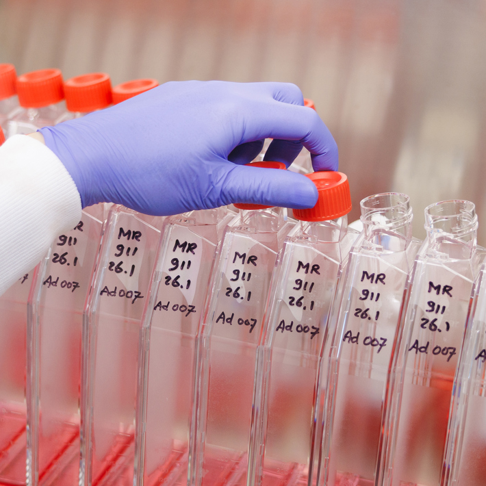 Adenovirus production